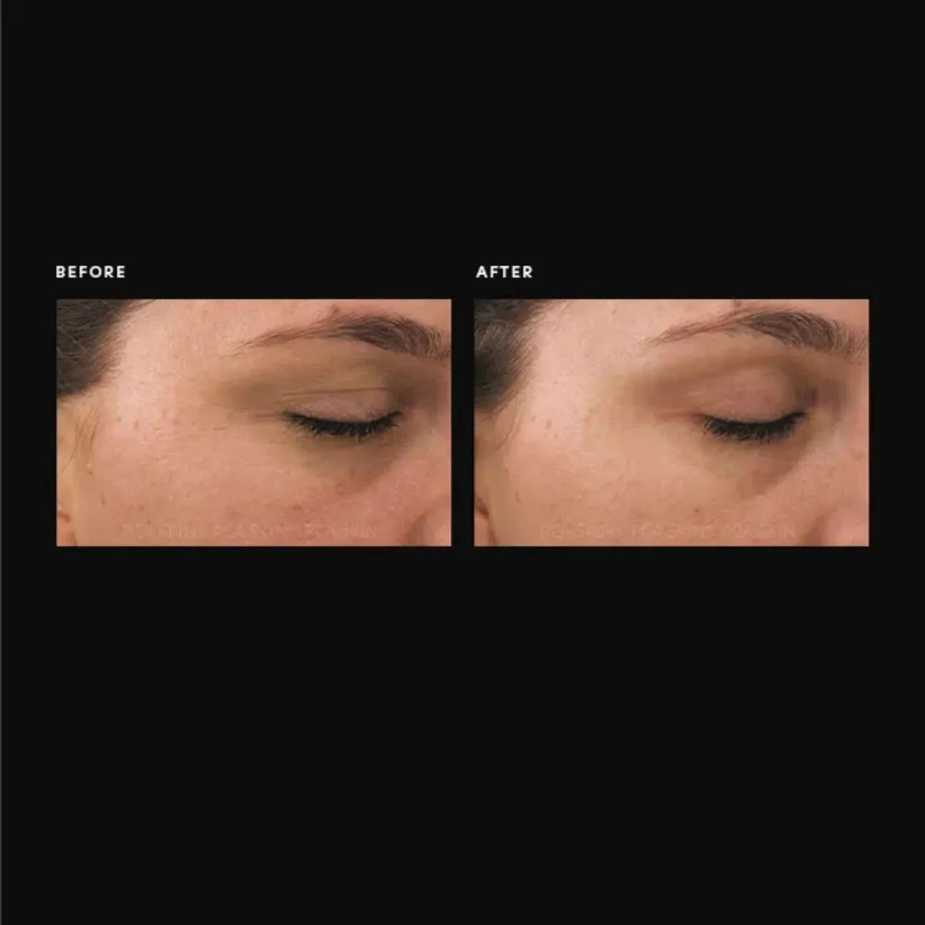 PCA Ideal Complex Revitalizing Eye Gel