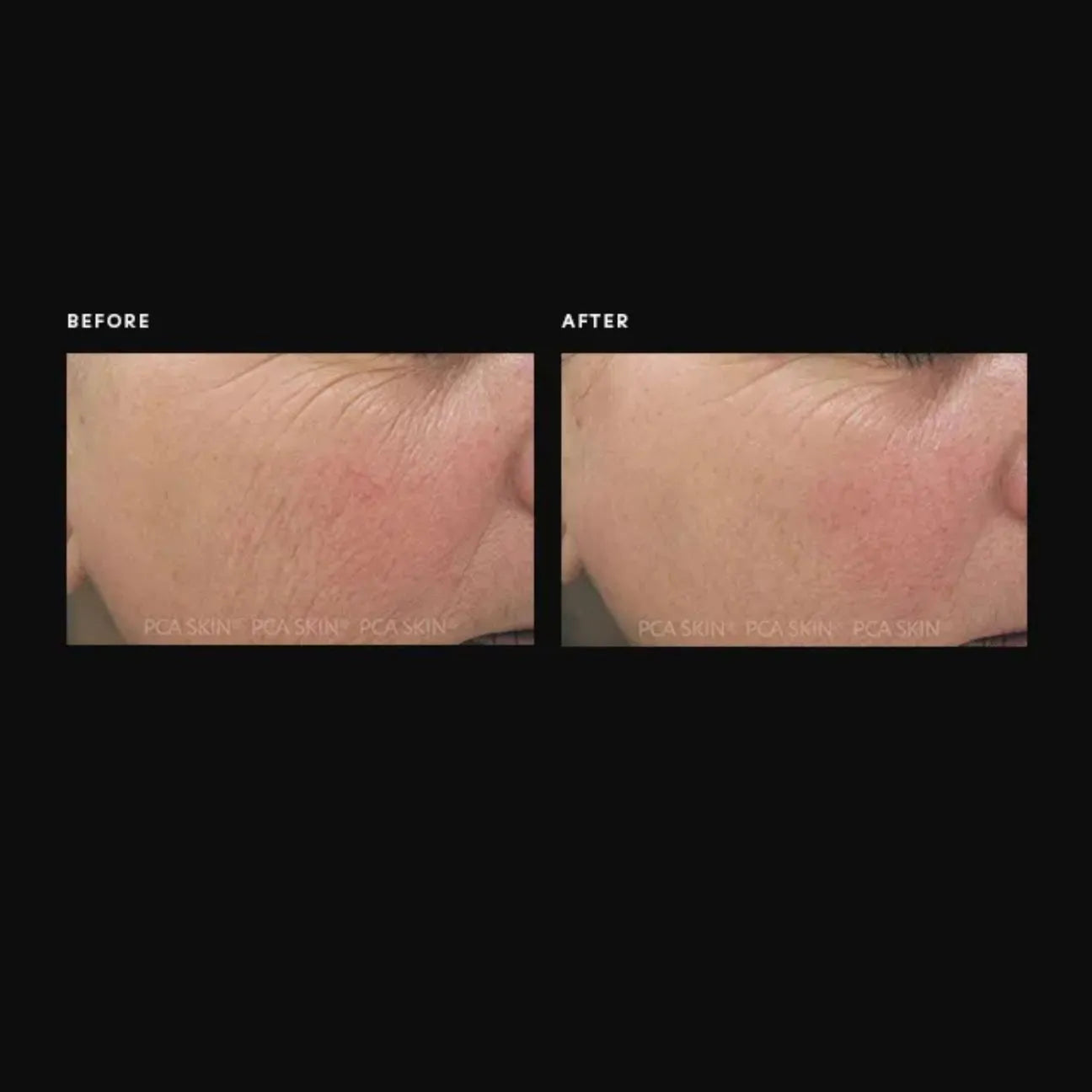 PCA C Quench Antioxidant Serum