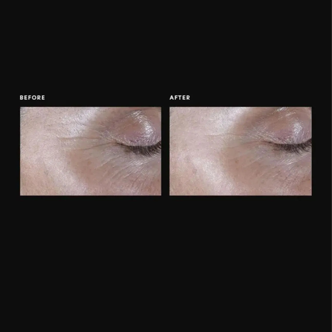 PCA ExLinea Pro Peptide Serum