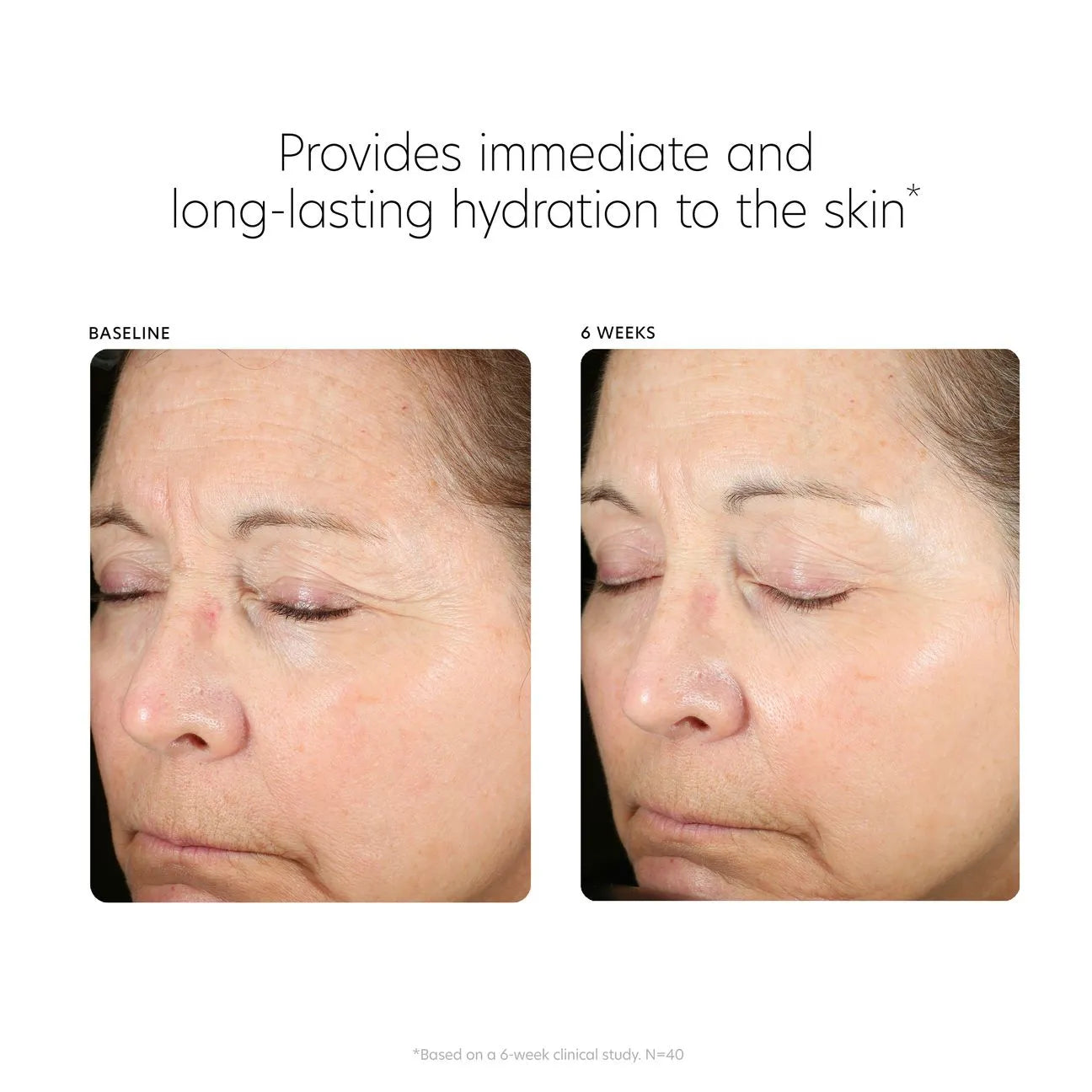 PCA Hyaluronic Acid Boosting Serum