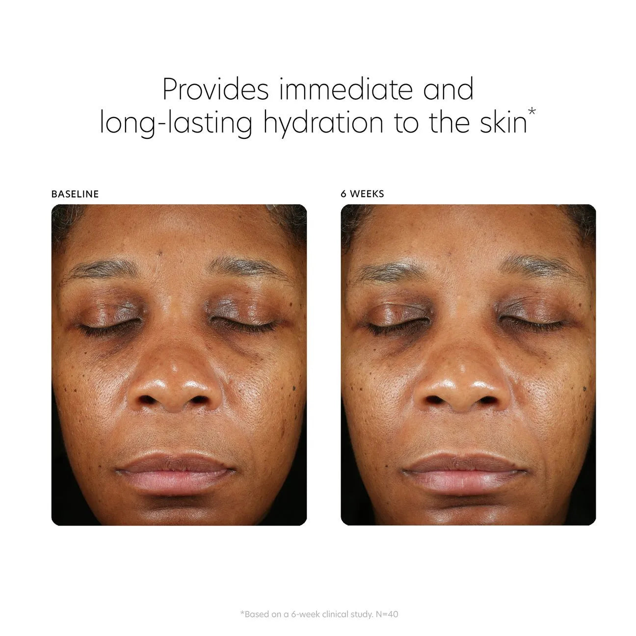 PCA Hyaluronic Acid Boosting Serum