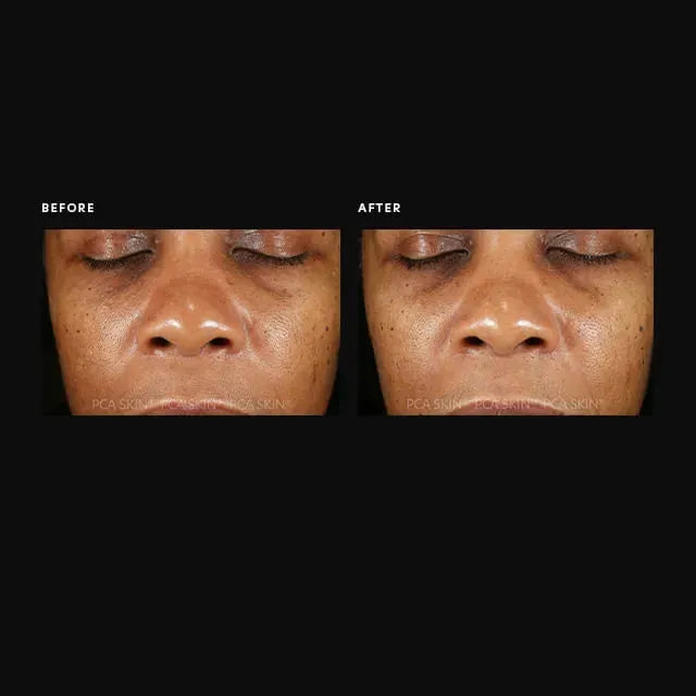 PCA Hyaluronic Acid Overnight Mask