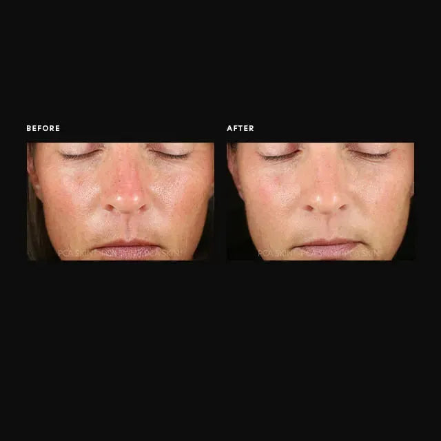 PCA Hyaluronic Acid Overnight Mask