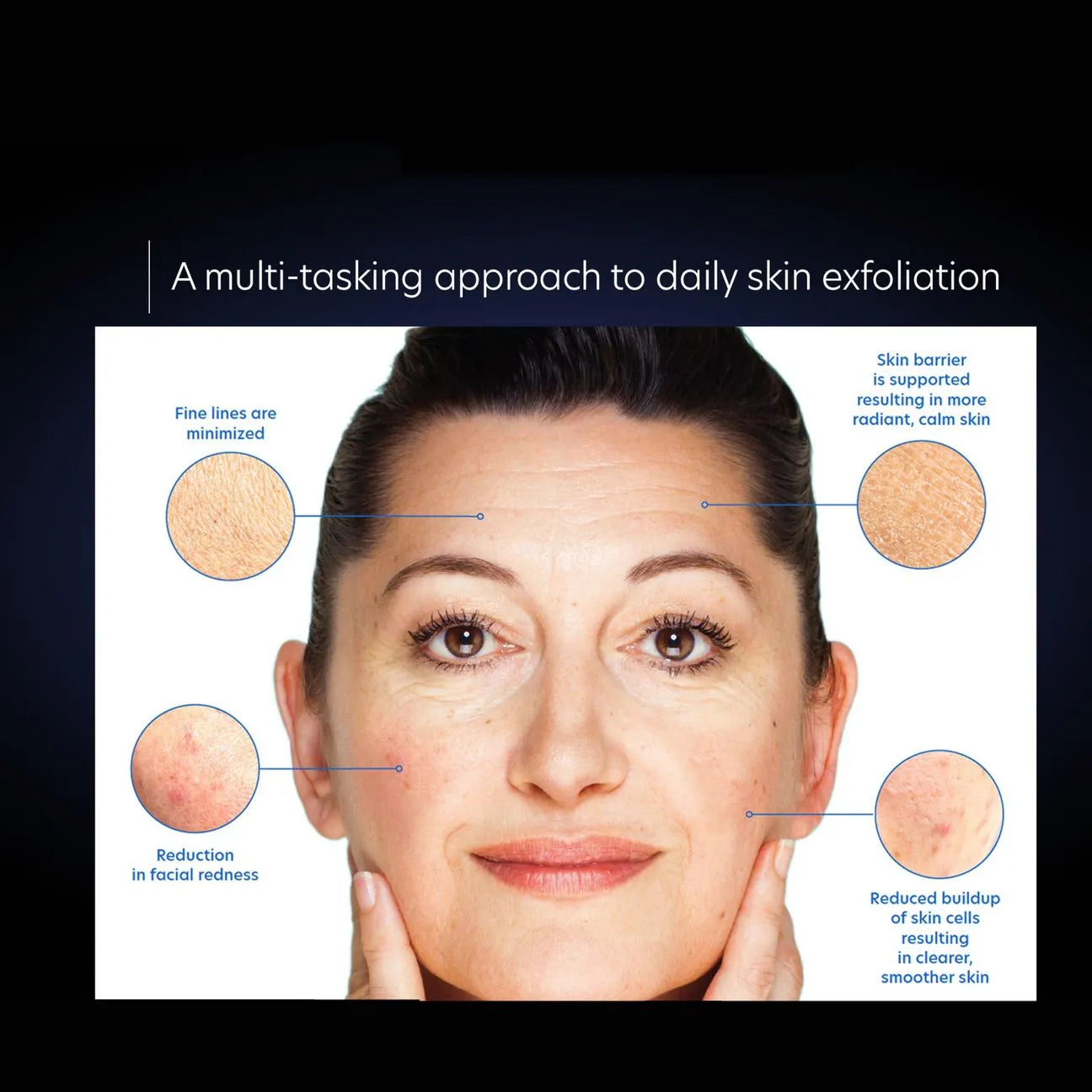 PCA Resurfacing Serum