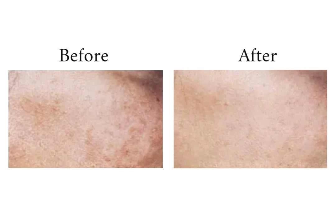 PCA Pigment Gel HQ Free